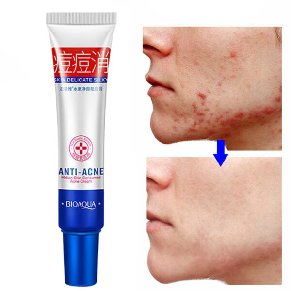 کرم ضد جوش بایو آکوا مدل ACNE ELIMINATION وزن 30 گرم